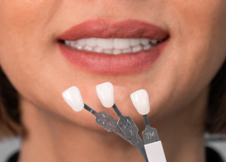 Oral_White_Dra_Lizeth_Duran_odontologia_bogota_odontologia_estética
