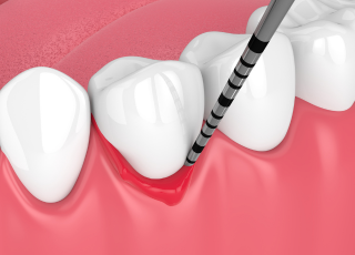 Oral_White_Dra_Lizeth_Duran_odontologia_bogota_periodoncia