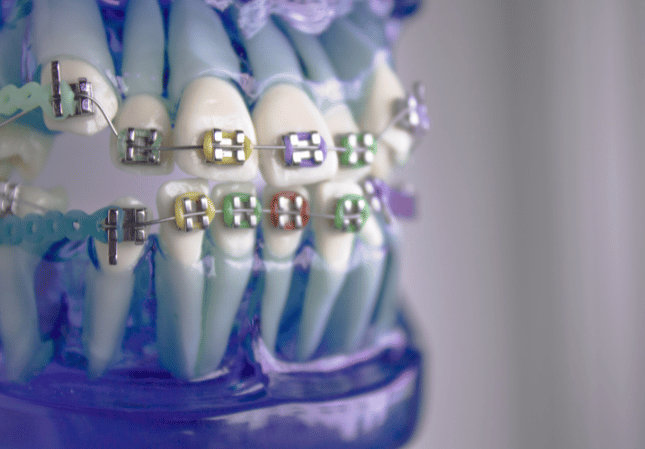 Oral_White_Dra_Lizeth_Duran_odontologia_bogota_Perdomo_villa_del_rio_1
