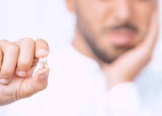 Oral_White_Dra_Lizeth_Duran_odontologia_bogota_Perdomo_villa_del_rio_1-exodoncia
