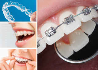 Oral_White_Dra_Lizeth_Duran_odontologia_bogota_Perdomo_villa_del_rio_1-ortodoncia